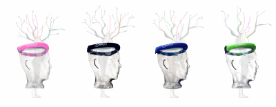 Alles &uuml;ber Balance-Halo&reg;